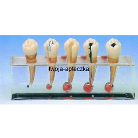 Model chorób endodontycznych HUG/B10015/2